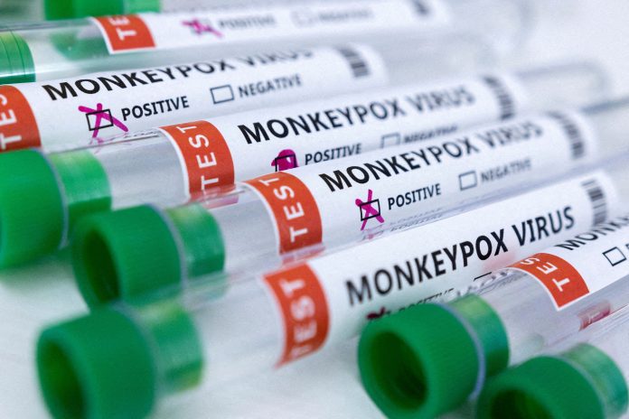 monkeypox positive